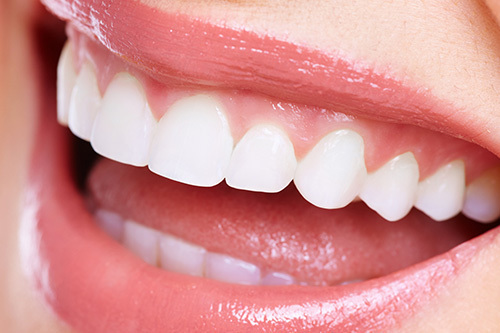 矯正治療の種類・料金 - アンビー歯科・矯正歯科（合志市）